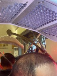 -碧莲盛·不剃发植发