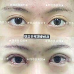 -北京丽星翼美医疗美容