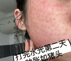 -海涛医疗美容·面部抗衰·注射美鼻