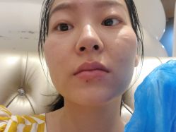 -洁铭新加坡医美