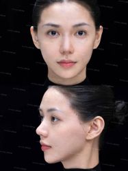 -深圳艺星医疗美容医院