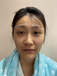 -北京米扬丽格医疗美容·联合丽格鼻整形中心