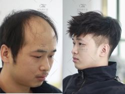 -发饰美男士增发补发假发定制店