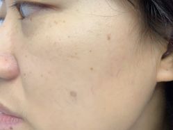 -广州美莱医疗美容医院
