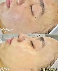 -skin79皮肤管理中心