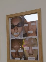 -美肤盾祛痘·问题肌头疗管理中心