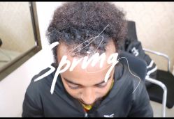 体验前-大麦微针植发全国连锁