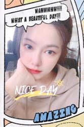 点击看大图 体验后-大麦微针植发全国连锁