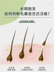-诗碧曼养发