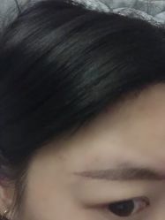 -南京健丽·去眼袋医疗美容机构