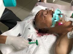 -杭州市富阳区第一人民医院