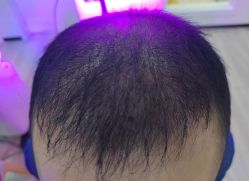 -雍禾植发全国连锁