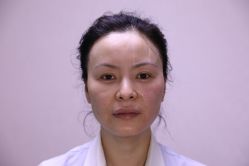 -北京叶子整形美容医院