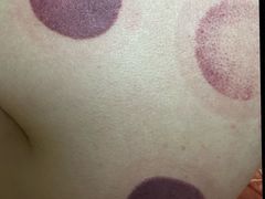 -沈师傅盲人按摩工作室(密三小区店)