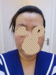 体验后-西美医疗美容门诊部