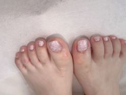 -赢韵美甲美睫瑞士净斑中心