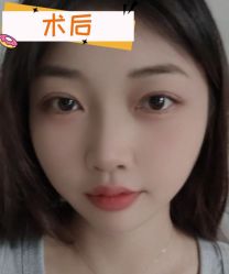 -素美医疗美容·西南眼鼻整形·修复基地