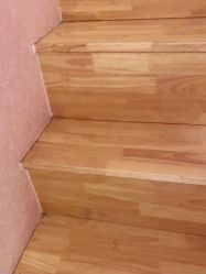 -薇兰专业脱毛连锁机构