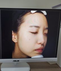 -丽美妍医疗美容·皮秒·立体分层抗衰