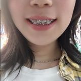 做金属矫正你会后悔吗？