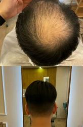 -乐绅男士高端假发定制