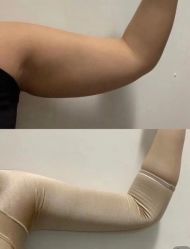 -弘美医美·艾维岚童颜抗衰中心