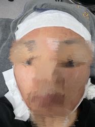 -叶美人医疗美容