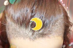 -大麦微针植发全国连锁