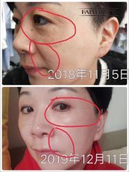 -凡碧诗毛孔收细