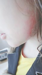 -天津健丽·去眼袋医疗美容机构