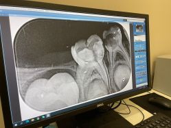 -青苗儿童口腔(长楹天街购物中心)