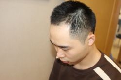 -大麦微针植发丨全国连锁