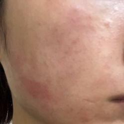 体验后-天津伊美尔医疗整形美容专科医院