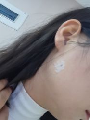-成都西区医院整形美容