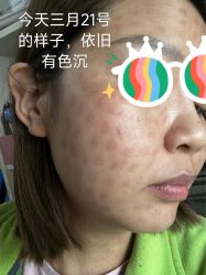 -海涛医疗美容·面部抗衰·注射美鼻