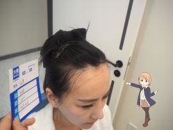 -大麦微针植发丨全国连锁