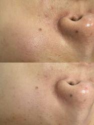 点击看大图 -E.beauty驻颜·痘敏肌调理中心