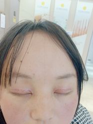 点击看大图 -Yestar宁波艺星整形医院