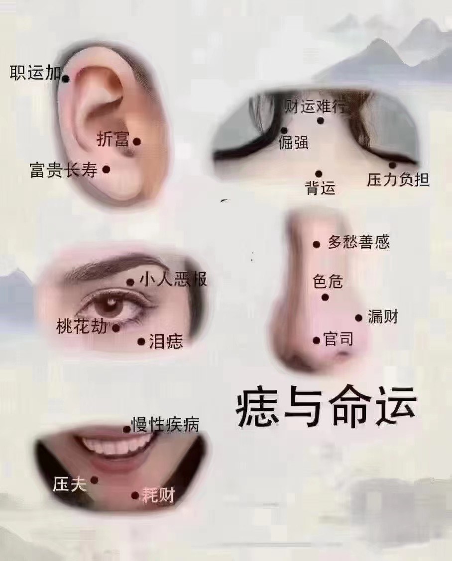 眉尾痣图解图片