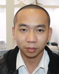 -大麦微针植发全国连锁