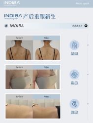 点击看大图 -半岛故事·法儿曼抗衰·indiba中心