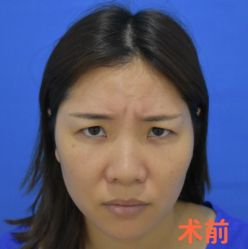 -天津健丽·去眼袋医疗美容机构