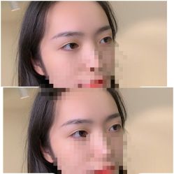 -久匠·纹眉半永久野生眉