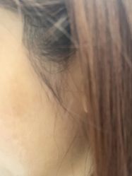 -美瑞莎创美医疗美容