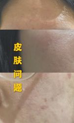 点击看大图 -Yestar宁波艺星整形医院