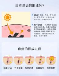 -苗方清颜痘肌研究所