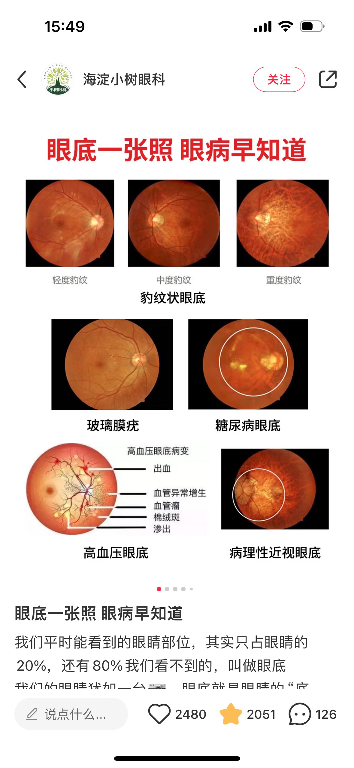 眼底检查的重要性‼️