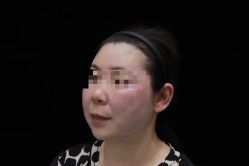 -上海漾颜医疗美容