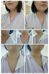 体验后-天津伊美尔医疗整形美容专科医院