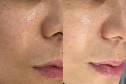 -SKIN79皮肤管理中心
